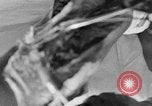 Image of leg surgery on wounded soldier France, 1918, second 14 stock footage video 65675042425