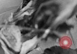 Image of leg surgery on wounded soldier France, 1918, second 15 stock footage video 65675042425