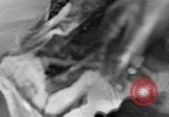 Image of leg surgery on wounded soldier France, 1918, second 16 stock footage video 65675042425
