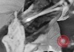 Image of leg surgery on wounded soldier France, 1918, second 17 stock footage video 65675042425