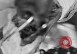 Image of leg surgery on wounded soldier France, 1918, second 18 stock footage video 65675042425