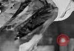Image of leg surgery on wounded soldier France, 1918, second 19 stock footage video 65675042425