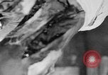 Image of leg surgery on wounded soldier France, 1918, second 20 stock footage video 65675042425
