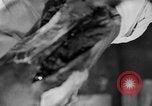 Image of leg surgery on wounded soldier France, 1918, second 21 stock footage video 65675042425