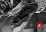 Image of leg surgery on wounded soldier France, 1918, second 23 stock footage video 65675042425