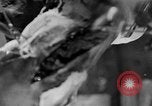 Image of leg surgery on wounded soldier France, 1918, second 27 stock footage video 65675042425