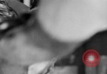 Image of leg surgery on wounded soldier France, 1918, second 28 stock footage video 65675042425