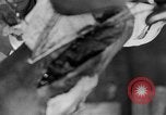 Image of leg surgery on wounded soldier France, 1918, second 30 stock footage video 65675042425