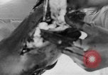 Image of leg surgery on wounded soldier France, 1918, second 34 stock footage video 65675042425