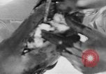 Image of leg surgery on wounded soldier France, 1918, second 35 stock footage video 65675042425