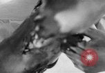 Image of leg surgery on wounded soldier France, 1918, second 36 stock footage video 65675042425