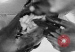 Image of leg surgery on wounded soldier France, 1918, second 37 stock footage video 65675042425