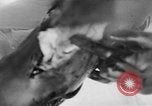 Image of leg surgery on wounded soldier France, 1918, second 39 stock footage video 65675042425