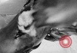 Image of leg surgery on wounded soldier France, 1918, second 40 stock footage video 65675042425