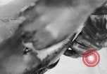 Image of leg surgery on wounded soldier France, 1918, second 41 stock footage video 65675042425