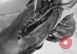 Image of leg surgery on wounded soldier France, 1918, second 42 stock footage video 65675042425