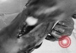 Image of leg surgery on wounded soldier France, 1918, second 44 stock footage video 65675042425