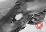 Image of leg surgery on wounded soldier France, 1918, second 45 stock footage video 65675042425