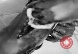 Image of leg surgery on wounded soldier France, 1918, second 46 stock footage video 65675042425