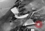 Image of leg surgery on wounded soldier France, 1918, second 48 stock footage video 65675042425