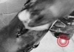 Image of leg surgery on wounded soldier France, 1918, second 49 stock footage video 65675042425