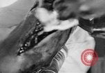 Image of leg surgery on wounded soldier France, 1918, second 51 stock footage video 65675042425