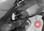 Image of leg surgery on wounded soldier France, 1918, second 52 stock footage video 65675042425