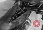 Image of leg surgery on wounded soldier France, 1918, second 53 stock footage video 65675042425