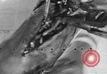 Image of leg surgery on wounded soldier France, 1918, second 54 stock footage video 65675042425