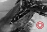Image of leg surgery on wounded soldier France, 1918, second 55 stock footage video 65675042425