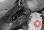 Image of leg surgery on wounded soldier France, 1918, second 56 stock footage video 65675042425