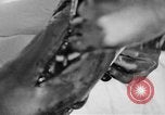 Image of leg surgery on wounded soldier France, 1918, second 57 stock footage video 65675042425