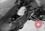 Image of leg surgery on wounded soldier France, 1918, second 58 stock footage video 65675042425