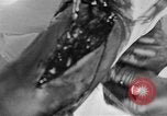 Image of leg surgery on wounded soldier France, 1918, second 60 stock footage video 65675042425