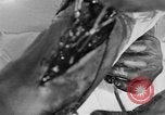 Image of leg surgery on wounded soldier France, 1918, second 61 stock footage video 65675042425