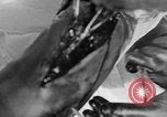 Image of leg surgery on wounded soldier France, 1918, second 62 stock footage video 65675042425