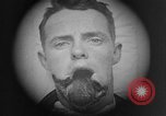 Standbild Gesichtsbehandlung Wunden auf Ersten Weltkrieg Soldaten Frankreich, 1918, aus Sekunde 12 historischem Filmmaterial Videoclip 65675042426
