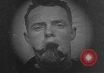 Standbild Gesichtsbehandlung Wunden auf Ersten Weltkrieg Soldaten Frankreich, 1918, aus Sekunde 18 historischem Filmmaterial Videoclip 65675042426