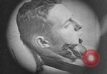 Standbild Gesichtsbehandlung Wunden auf Ersten Weltkrieg Soldaten Frankreich, 1918, aus Sekunde 20 historischem Filmmaterial Videoclip 65675042426