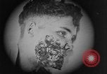 Image of injured soldier France, 1918, second 31 stock footage video 65675042433