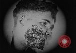 Image of injured soldier France, 1918, second 32 stock footage video 65675042433