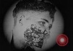 Image of injured soldier France, 1918, second 33 stock footage video 65675042433