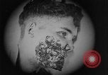 Image of injured soldier France, 1918, second 34 stock footage video 65675042433