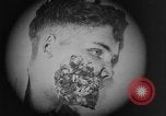 Image of injured soldier France, 1918, second 35 stock footage video 65675042433