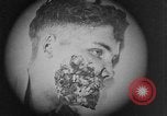 Image of injured soldier France, 1918, second 36 stock footage video 65675042433