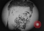 Image of injured soldier France, 1918, second 37 stock footage video 65675042433