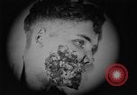Image of injured soldier France, 1918, second 39 stock footage video 65675042433