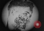 Image of injured soldier France, 1918, second 41 stock footage video 65675042433