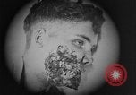 Image of injured soldier France, 1918, second 43 stock footage video 65675042433