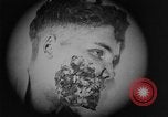 Image of injured soldier France, 1918, second 44 stock footage video 65675042433